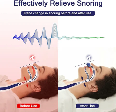 睡眠時無呼吸症候群といびき対策のコンパクトトラベルCPAPシステム