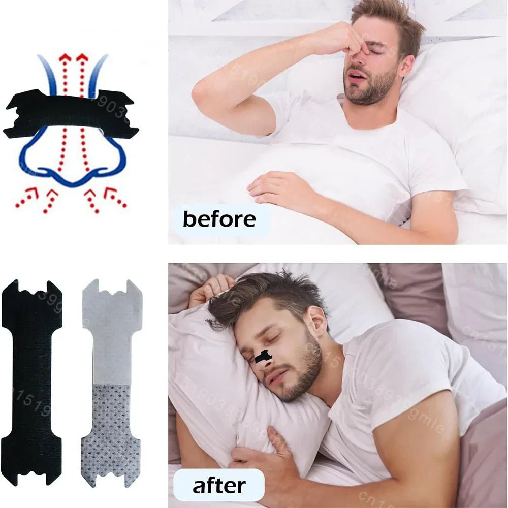BreatheEase orrszalagok horkolás ellen a tiszta légzésért és pihentető alvásért horkolóknak